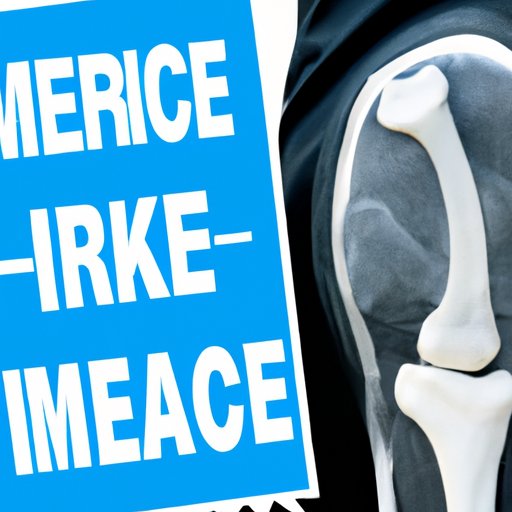 Exploring the Price Tag of Knee MRI Without Health Insurance