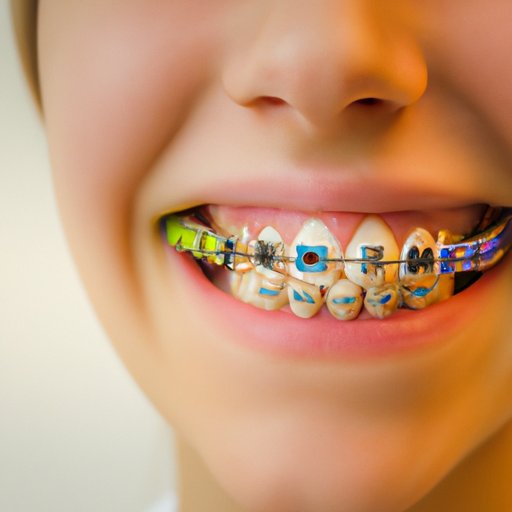 A Comprehensive Guide to Braces: Breaking Down the Cost
