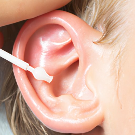 Using a Dropper to Fill the Ear with Hydrogen Peroxide and Draining it Out