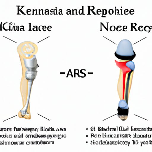 Comparison of Traditional and Advanced Knee Replacement Technologies
