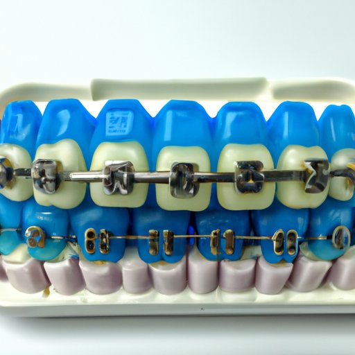 How Healthy Blue Cover Braces Can Improve Your Smile