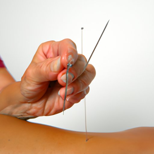 Exploring the Benefits of Acupuncture and How Medicare Covers It