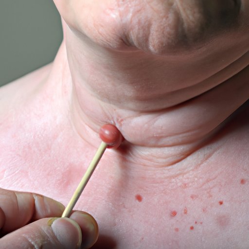 Tests to Confirm Swollen Lymph Nodes