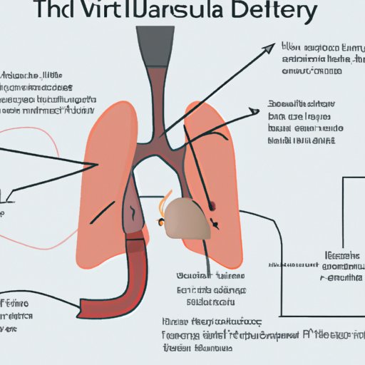 Describing the Anatomy of a DVT Journey to the Lung