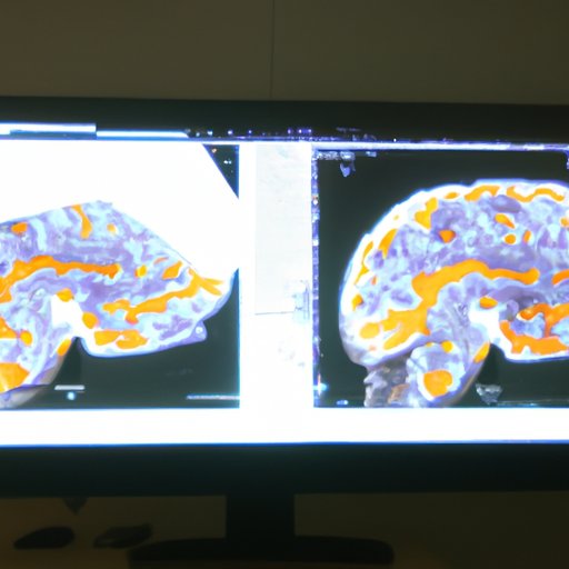 Analyzing the Brain Imaging Effects of Psilocin