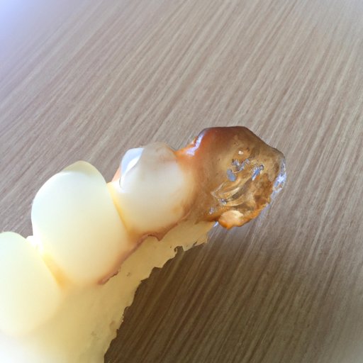 What to Expect When Eating After a Crown is Cemented