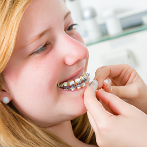 When to Fill the Cavity Before Getting Braces