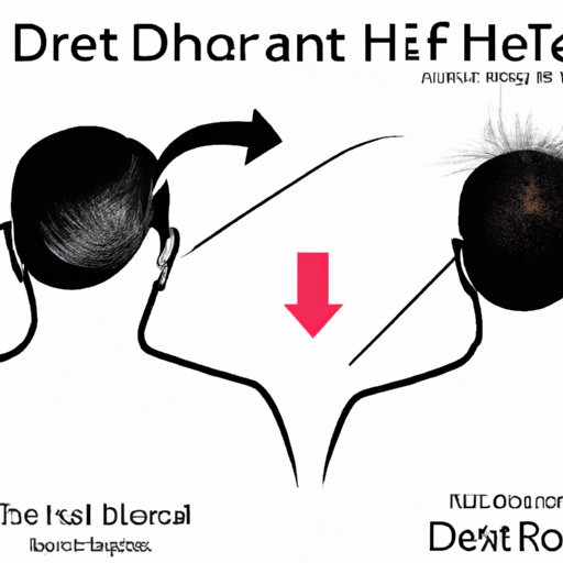 The Role of DHT in Hair Loss