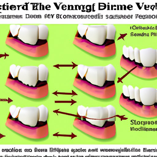 How Long Does it Take to Get Veneers? A Comprehensive Guide The