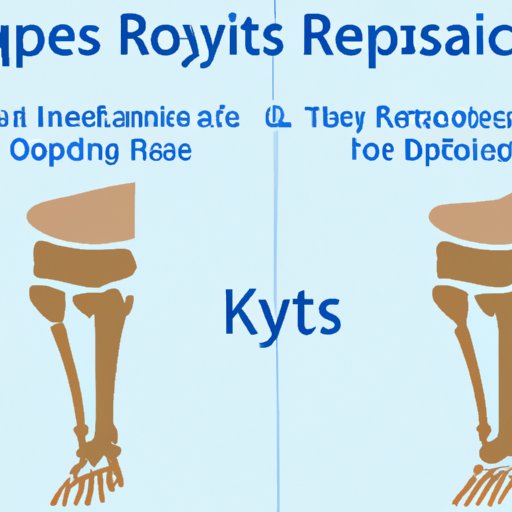 Comparing Traditional vs. Robotic Knee Replacement Surgery Times