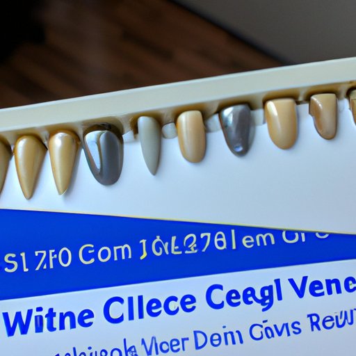 Breaking Down the Average Cost of Porcelain Veneers