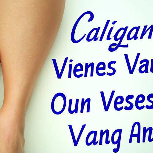 What You Need to Know About the Costs of Varicose Vein Treatments