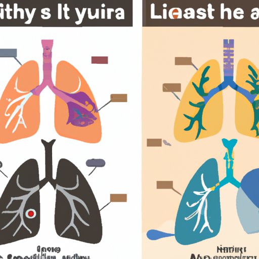 Comparing Unhealthy and Healthy Lungs