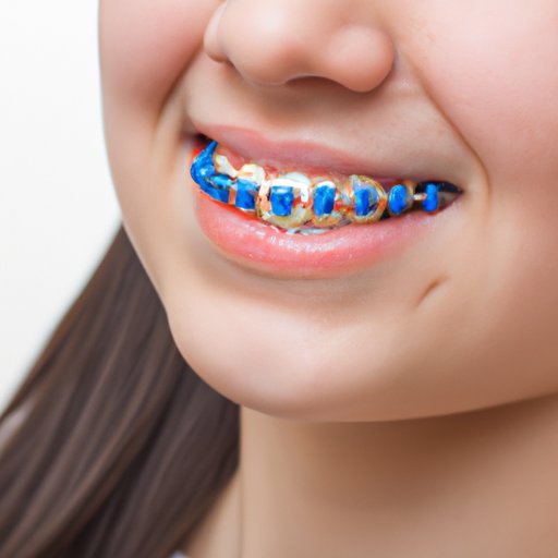 Does Healthy Blue Cover Braces Work? Benefits, Health Benefits and Pros