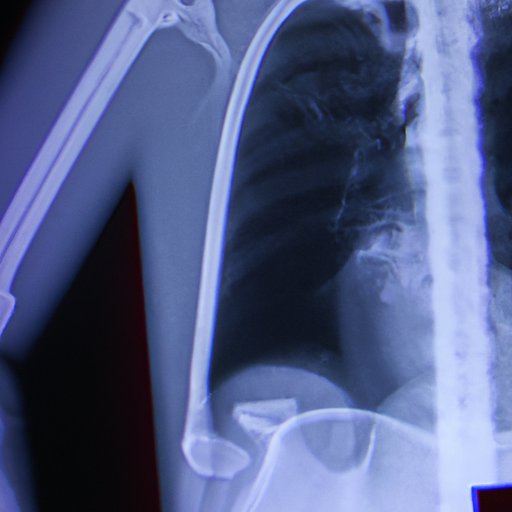 Who Invented the XRay? Exploring Wilhelm Roentgen’s Revolutionary